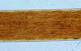 Как выглядят волосы под микроскопом?