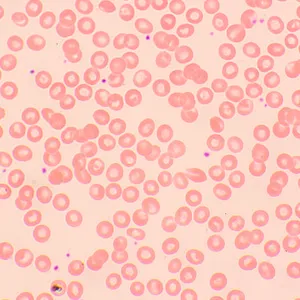 Микроскоп биологический MAGUS Bio 250TL, изображение 22