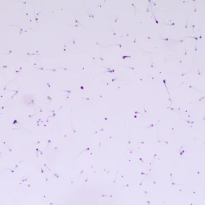 Микроскоп биологический MAGUS Bio 260T, изображение 22